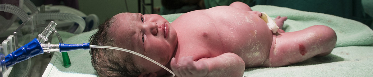Keizersnede pasgeboren baby via keizersnede Kraamzorg de Waarden 