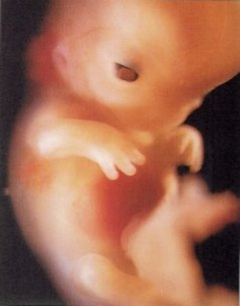 foetus 11 weken